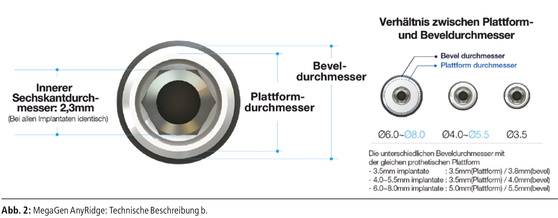 MegaGen_Prof.Dr.Dr. Schermer_Abbildung 2