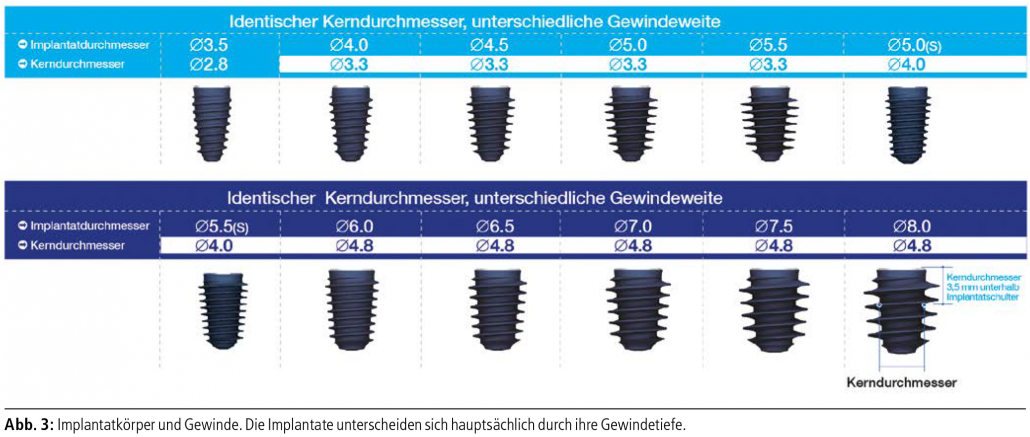 MegaGen_Prof.Dr.Dr. Schermer_Abbildung 3