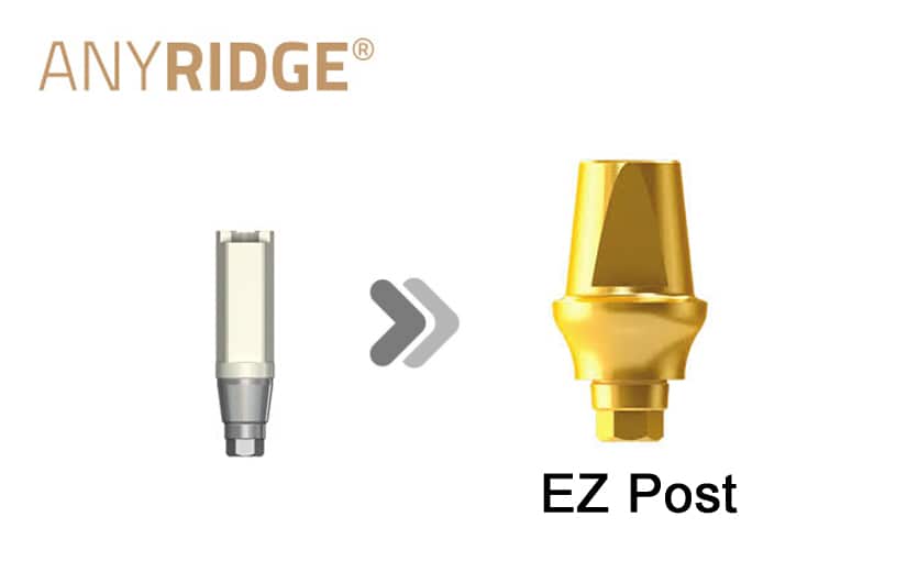 AnyRidge EZ Post(Stock abutment)