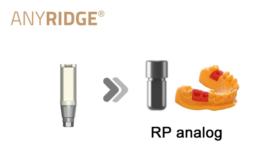 AnyRidge RP(3D print model)