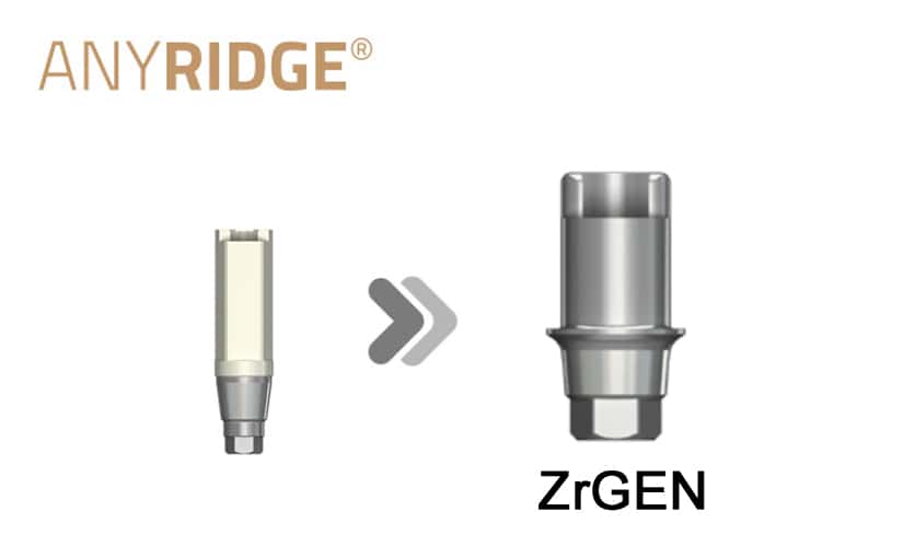 AnyRidge ZrGEN(Ti-base)