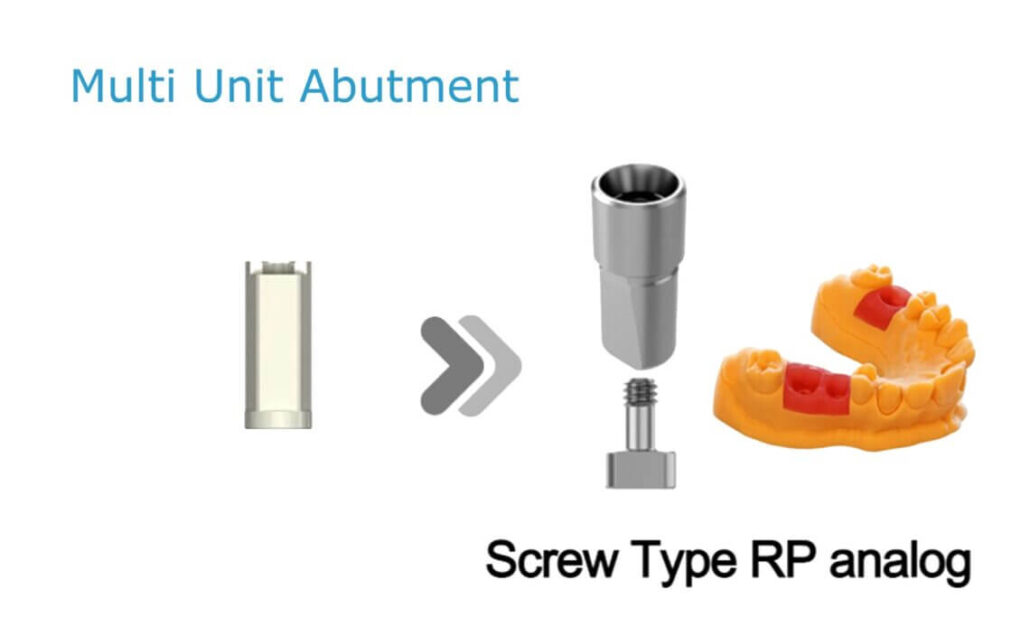 MUA RP_Screw type (3D print model)