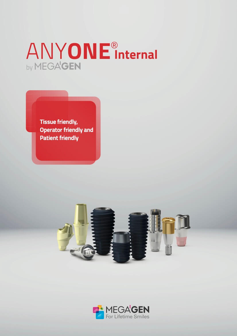 Anyone Internal